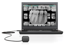 dental digital X-ray pasadena